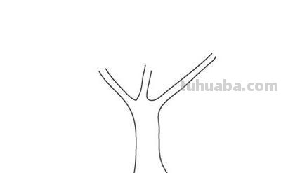 简笔画大树怎么画（简笔画大树怎么画漂亮）