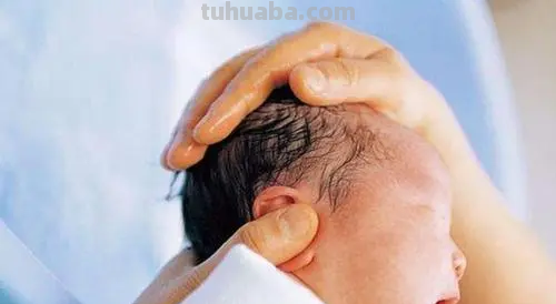 宝宝头发少和哪些因素有关?