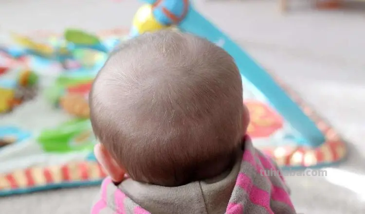 宝宝头发少和哪些因素有关?