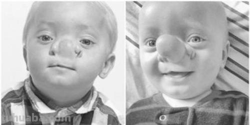 小男孩长了古怪的鼻子是什么故事 小男孩长了古怪的鼻子是什么故事呢