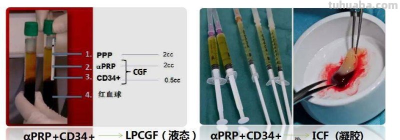 CGF cgf是什么意思