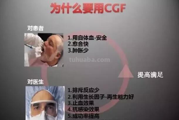 CGF cgf是什么意思