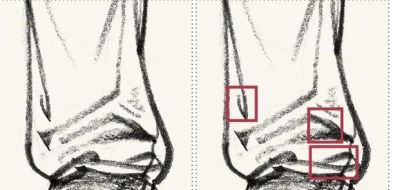 线条是速写的表现语言（三）回头线/结构点线 - 图画吧TUHUABA